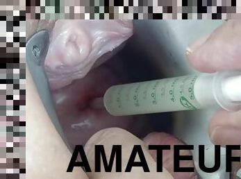 Artificial insemination - Amateurs