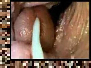 Ejaculation interne